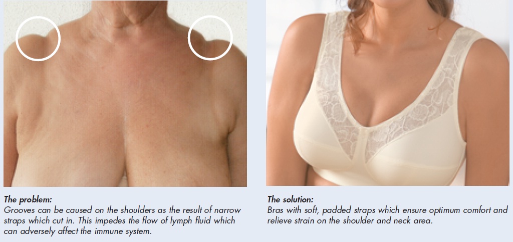 Posture Bras Help Relieve Shoulder or Neck Strain Caused by Breast