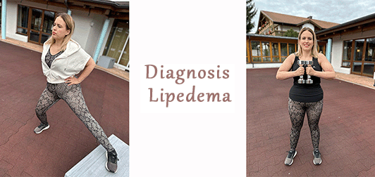 Diagnosis lipedema Part 4